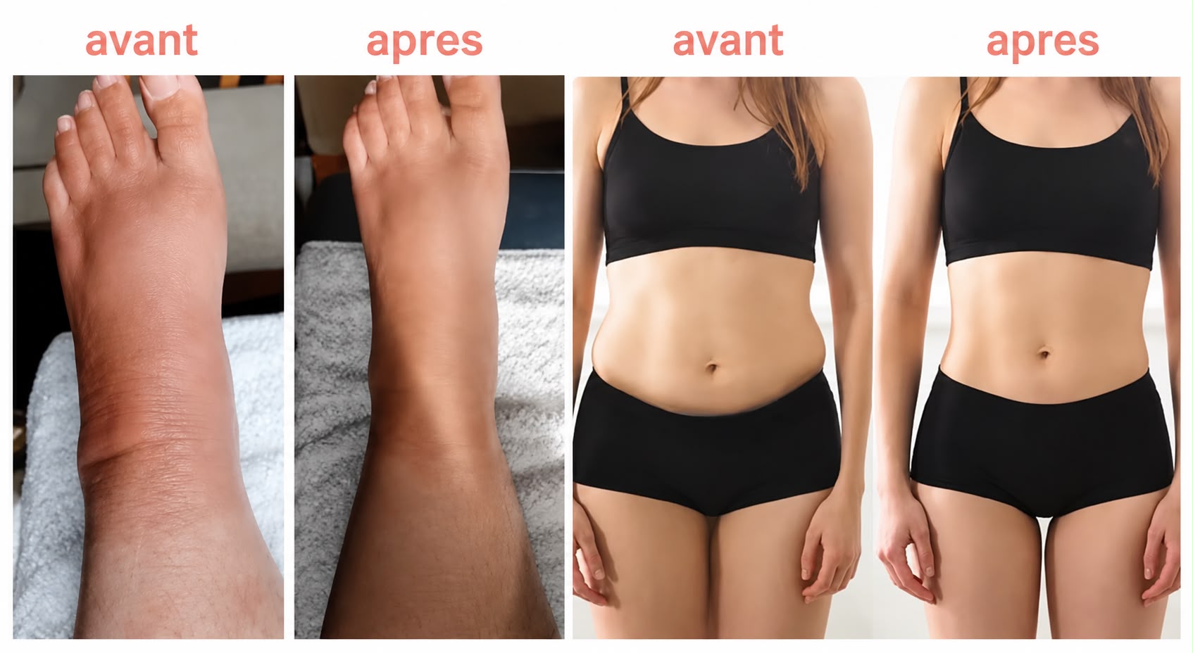 Avant et après séances de drainage lymphatique par pressothérapie